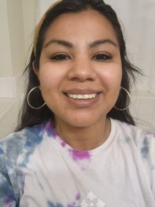 Results one month after neurotoxin administration.